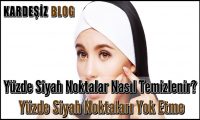 Yüzde Siyah Noktalar Nasıl Temizlenir