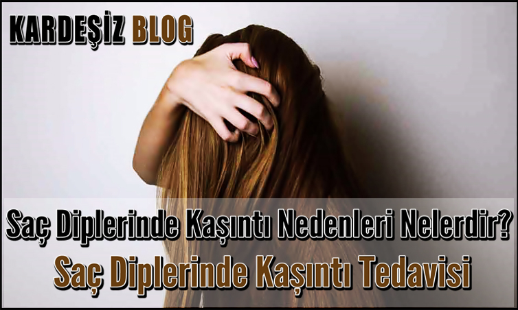 Saç Diplerinde Kaşıntı Nedenleri Nelerdir