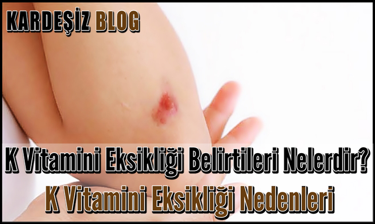 K Vitamini Eksikliği Belirtileri Nelerdir