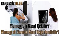 Mamografi Nasıl Çekilir