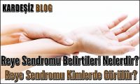 Reye Sendromu Belirtileri Nelerdir