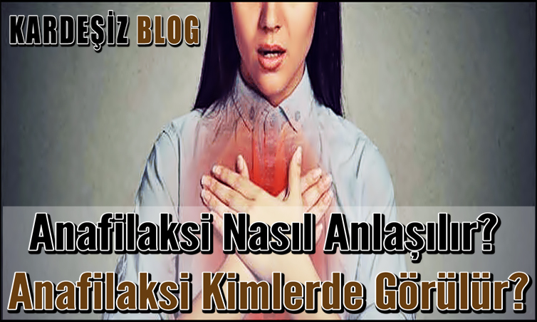 Anafilaksi Nasıl Anlaşılır