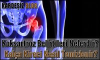 Koksartroz Belirtileri Nelerdir