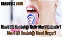 Mavi Dil Hastalığı Belirtileri Nelerdir