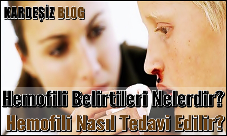 Hemofili Belirtileri Nelerdir