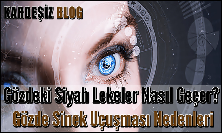 Gözdeki Siyah Lekeler Nasıl Geçer