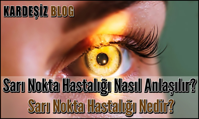 Sarı Nokta Hastalığı Nasıl Anlaşılır