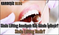 Sinüs Lifting Ameliyatı Kaç Günde iyileşir