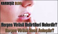 Herpes Virüsü Belirtileri Nelerdir