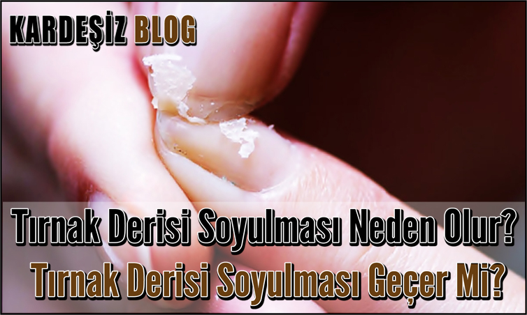 Tırnak Derisi Soyulması Neden Olur