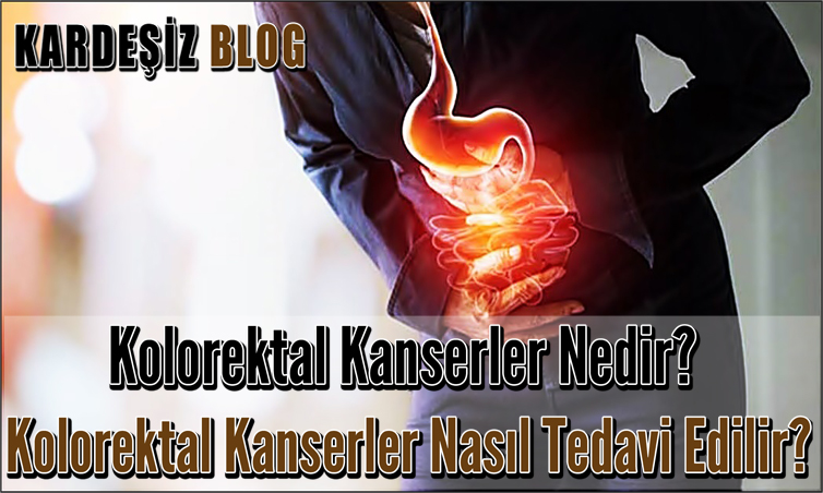 Kolorektal Kanserler Nedir