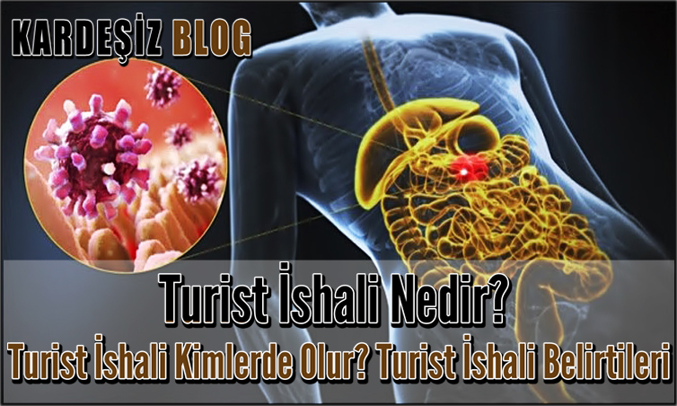 Turist ishali Nedir