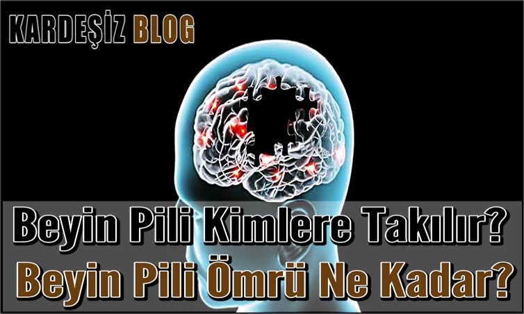 Beyin Pili Kimlere Takılır