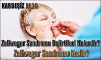 Zellweger Sendromu Belirtileri Nelerdir