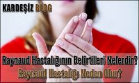 Raynaud Hastalığının Belirtileri Nelerdir