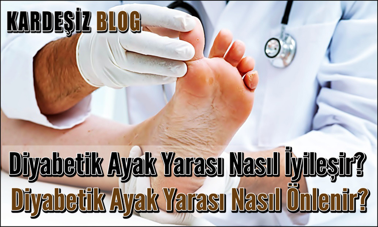 Diyabetik Ayak Yarası Nasıl iyileşir