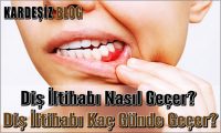 Diş iltihabı Nasıl Geçer