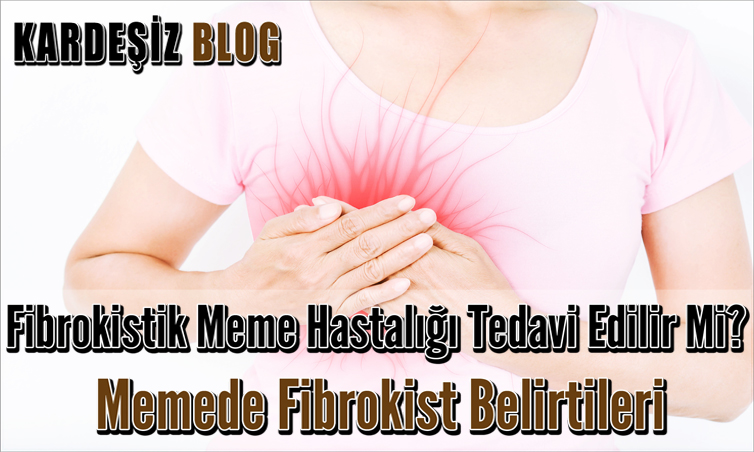 Fibrokistik Meme Hastalığı Tedavi Edilir Mi