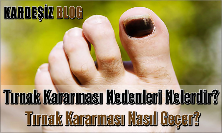 Tırnak Kararması Nedenleri Nelerdir