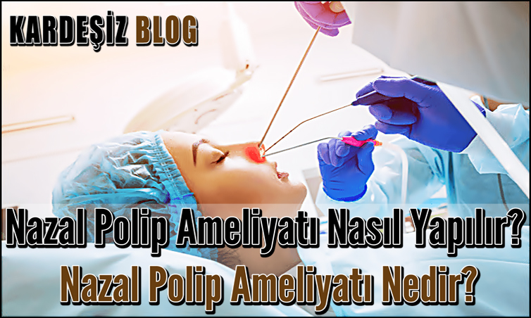 Nazal Polip Ameliyatı Nasıl Yapılır