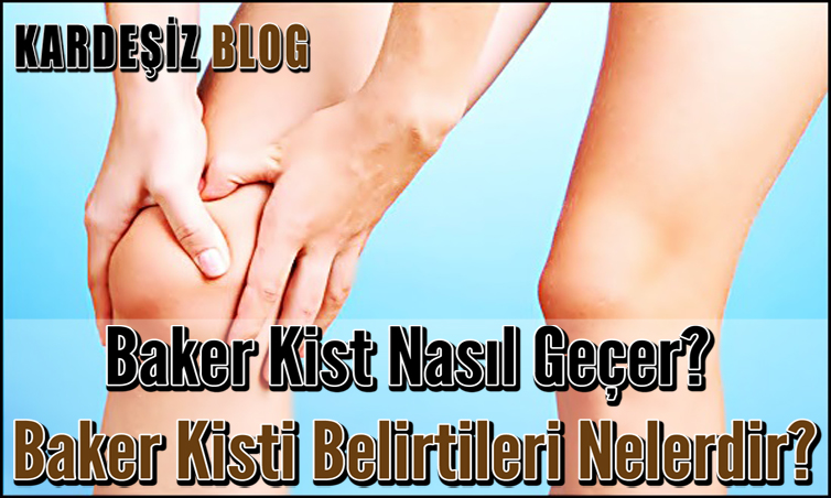 Baker Kist Nasıl Geçer