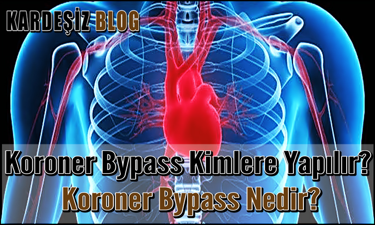 Koroner Bypass Kimlere Yapılır