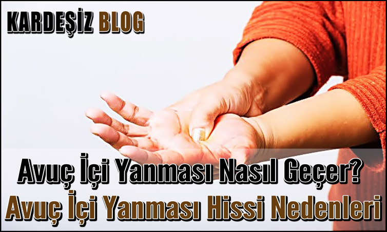 Avuç içi Yanması Nasıl Geçer