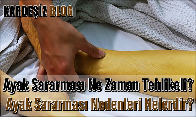 Ayak Sararması Ne Zaman Tehlikeli