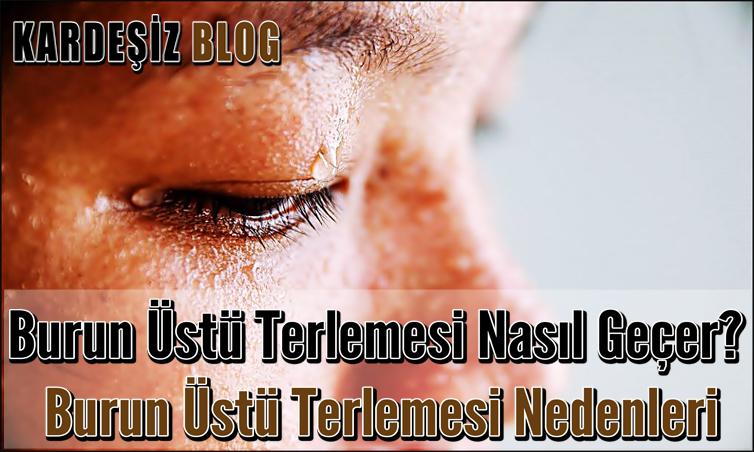 Burun Üstü Terlemesi Nasıl Geçer