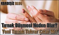 Tırnak Düşmesi Neden Olur