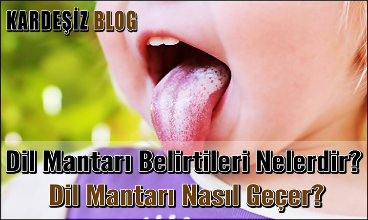 Dil Mantarı Belirtileri Nelerdir