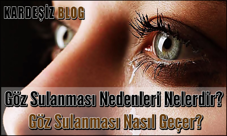 Göz Sulanması Nedenleri Nelerdir