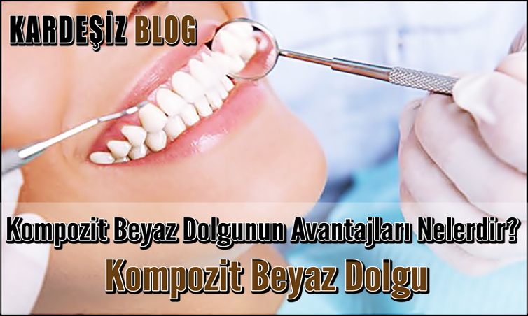 Kompozit Beyaz Dolgunun Avantajları Nelerdir