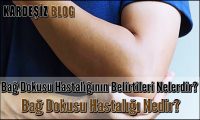 Bağ Dokusu Hastalığının Belirtileri Nelerdir