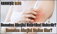 Domates Alerjisi Belirtileri Nelerdir