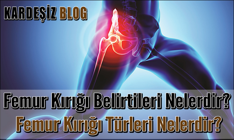 Femur Kırığı Belirtileri Nelerdir