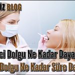 Geçici Dolgu Ne Kadar Dayanır