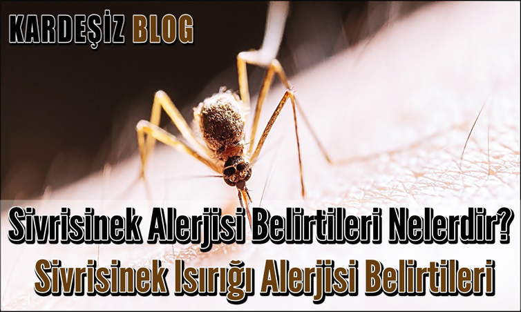 Sivrisinek Alerjisi Belirtileri Nelerdir