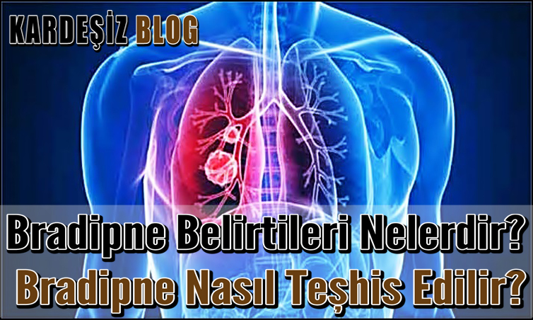 Bradipne Belirtileri Nelerdir