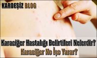 Karaciğer Hastalığı Belirtileri Nelerdir