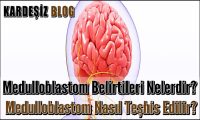 Medulloblastom Belirtileri Nelerdir