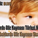 Bebeklerde Göz Kayması Türleri Nelerdir