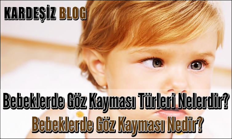 Bebeklerde Göz Kayması Türleri Nelerdir