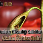 Alkalen Fosfataz Yüksekliği Belirtileri Nelerdir