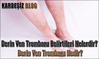 Derin Ven Trombozu Belirtileri Nelerdir