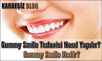 Gummy Smile Tedavisi Nasıl Yapılır