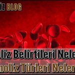 Hemoliz Belirtileri Nelerdir