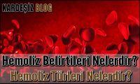 Hemoliz Belirtileri Nelerdir