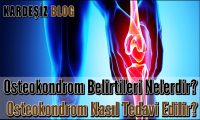 Osteokondrom​ Belirtileri Nelerdir