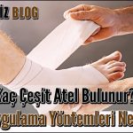 Kaç Çeşit Atel Bulunur